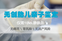 泰州需要怎么办理产前亲子鉴定